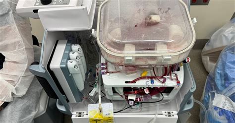 The Organ Is Still Working. But It’s Not in a Body Anymore..